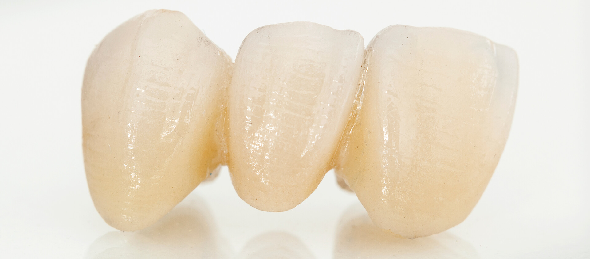 Branden, FL Area Patients Can Obtain Porcelain Dental Crowns for Teeth that Are Weak or Broken