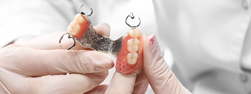 What to Expect From Partial Dentures  in Brandon, FL Area